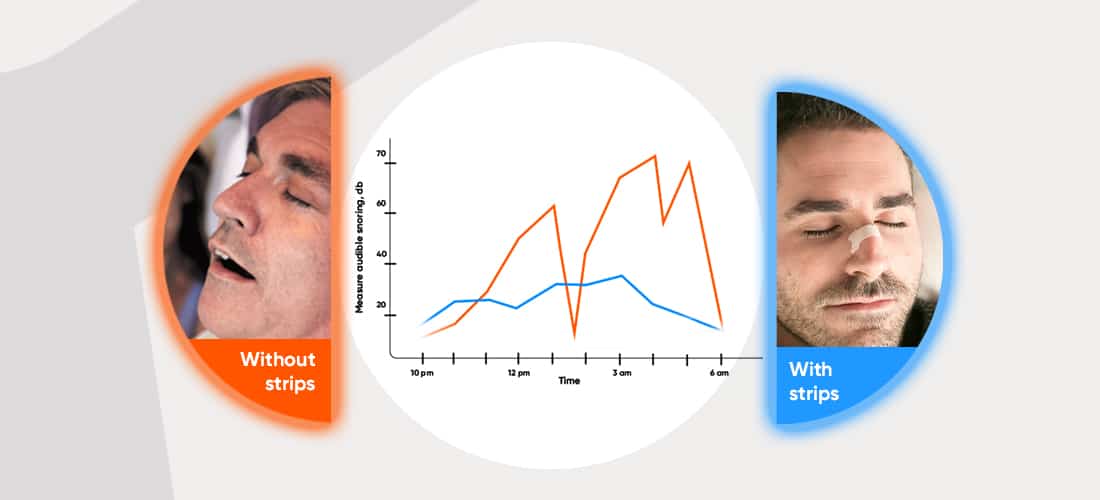 Nasal strips reduce snoring